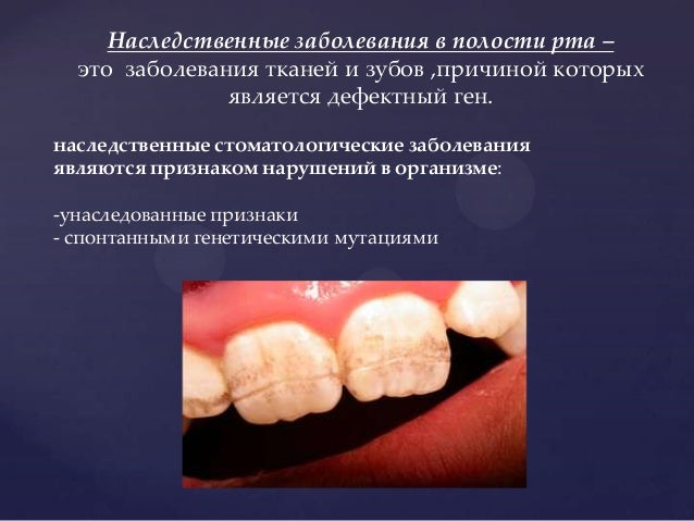 Врожденные патологии зубов Врожденные патологии зубов